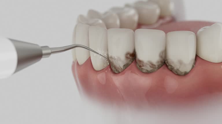 Reliable Teeth Cleaning And Checkup contractor in Nevada, MO by Smile Center Dentistry